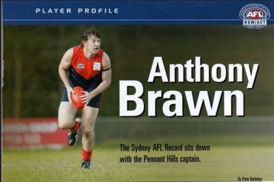 Anthony Brawn